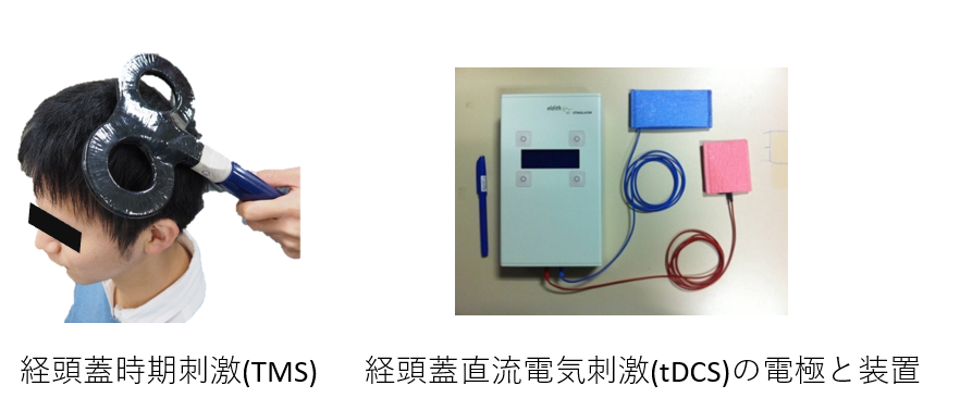 ○Brain おちこん Premier tDCS Device 経頭蓋磁気刺激
